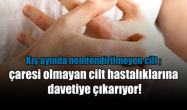 Kış ayı, cilt hastalıklarına davetiye çıkarıyor