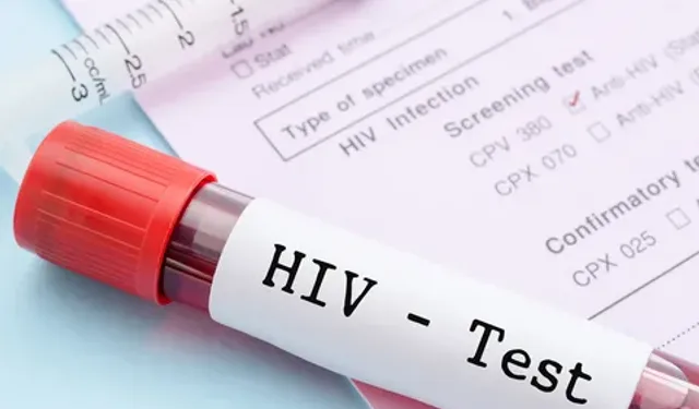 HIV’de İstanbul uyarısı