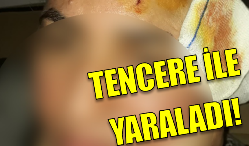 Tencere ile yaraladıktan sonra..